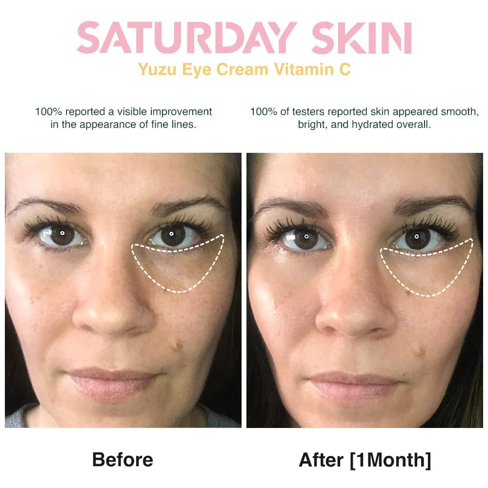Saturday Skin Yuzu Vitamin C Bright Eye Cream 15ml - Crema para Ojos de Vitamina C.- Producto Coreano