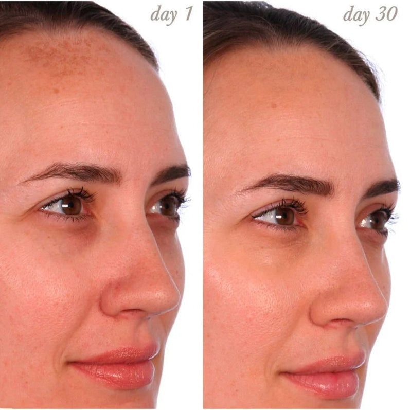 UBeauty Resurfacing Compound 30ml- Compuesto de Reacondicionamiento para Piel