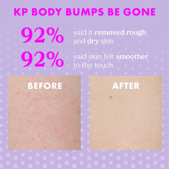 KOPARI Body Bumps Be Gone 7ml - Scrub para eliminar marcas en la piel
