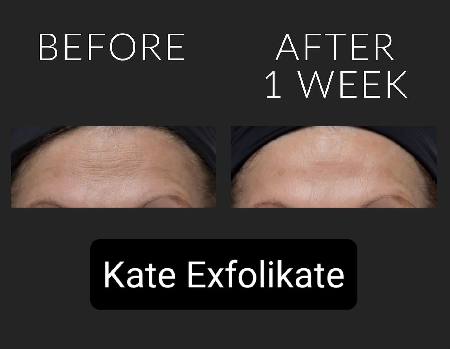 Kate Somerville Exfolikate Glow Moisturizer 50ml- Exfoliante Hidratante Luminoso