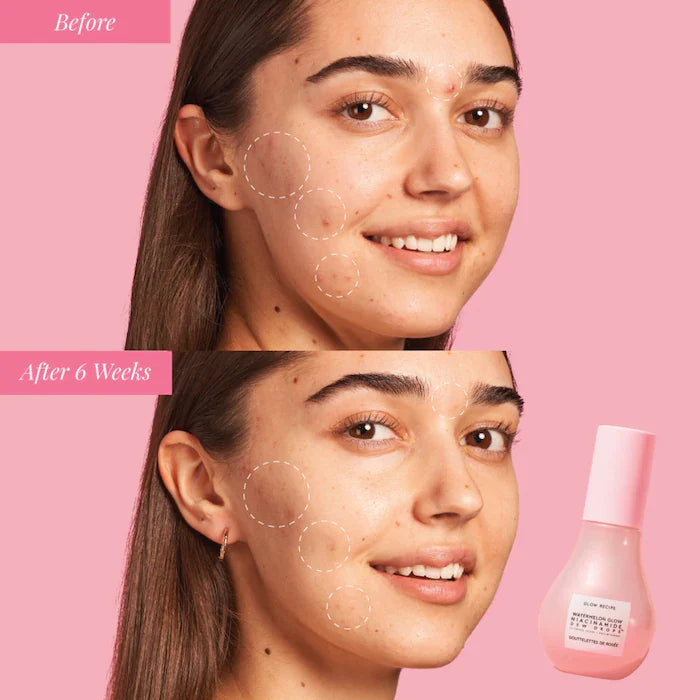 Glow Recipe Watermelon Glow Niacinamide Dew Drops 40ml - Gotas de Niacinamida