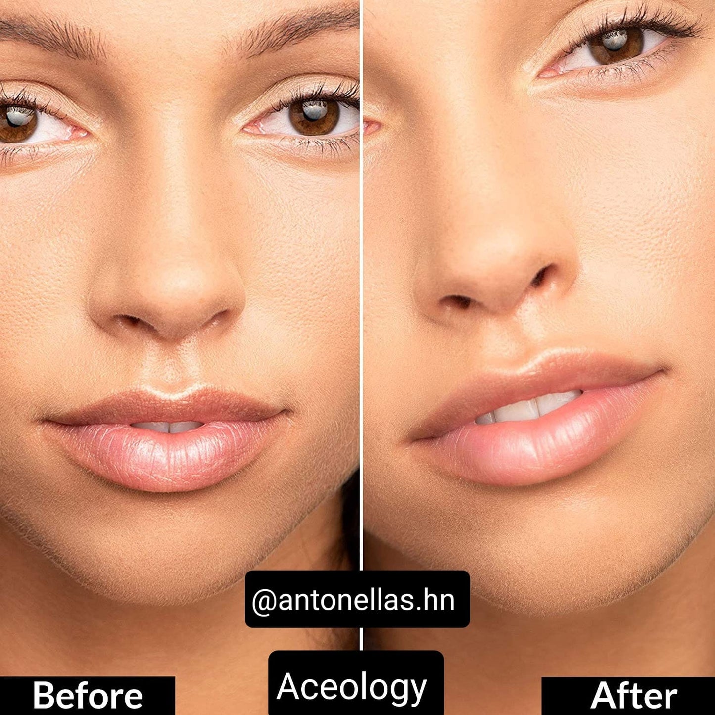Aceology Overnight Lip Mask 15ml - Mascarilla Noctura para Labios